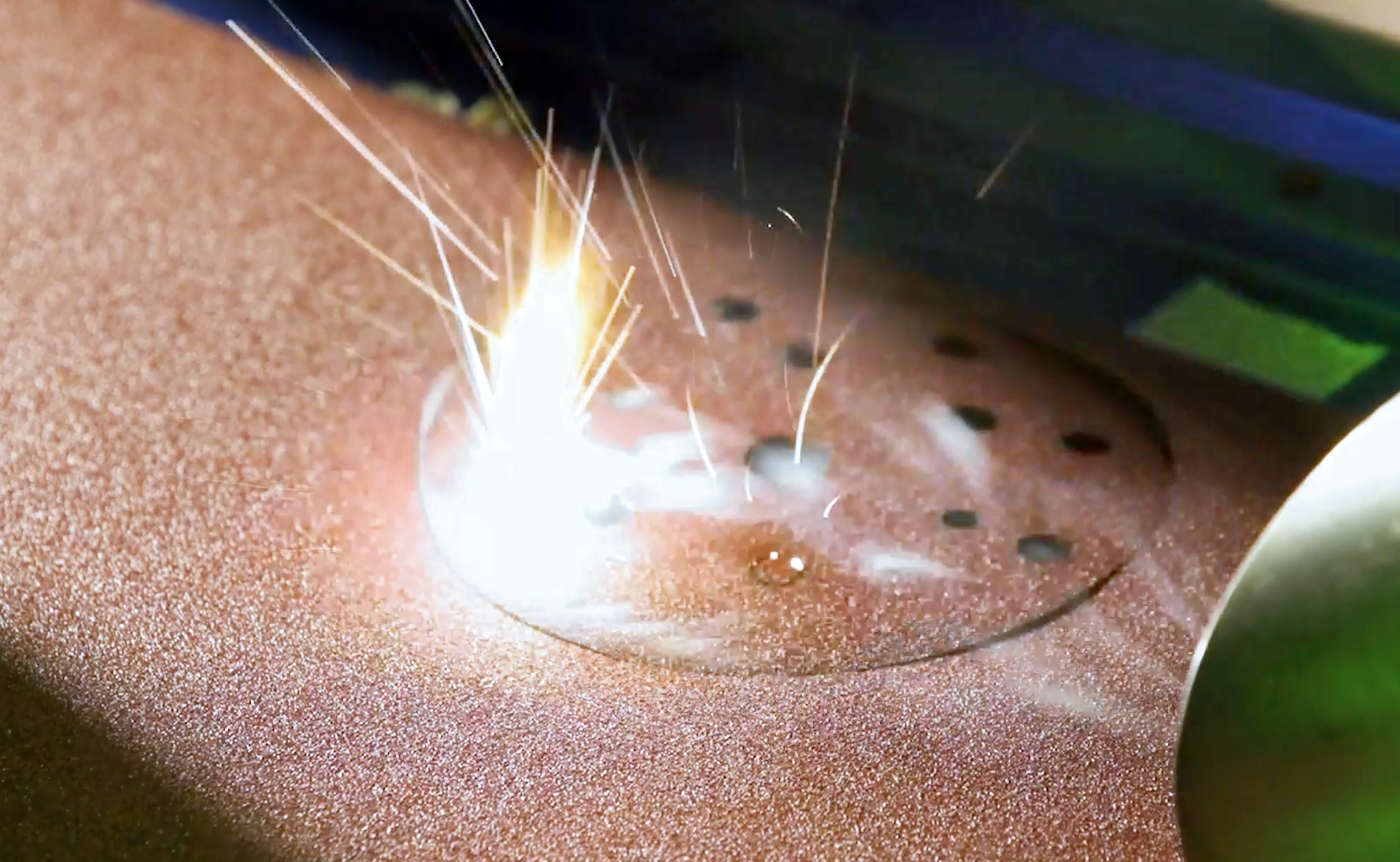 Precision CO2 Laser Cutting of Sandpaper Discs